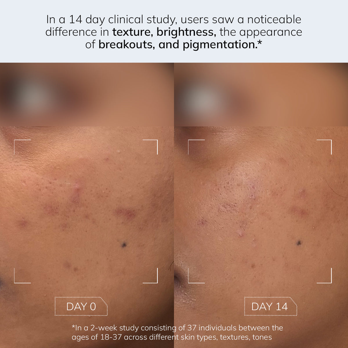 Evening Exfoliator - 5% AHA BHA PHA Toner