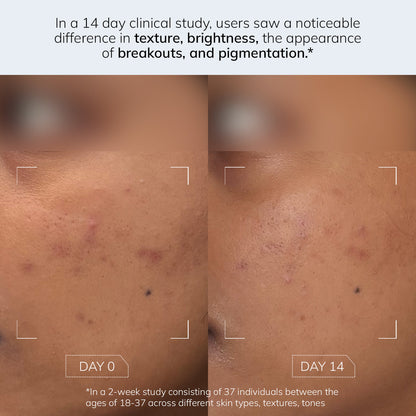 Evening Exfoliator - 5% AHA BHA PHA Toner