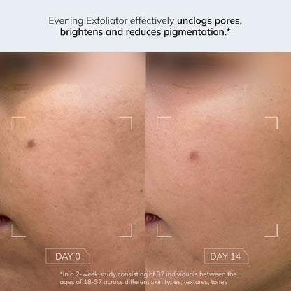 Evening Exfoliator - 5% AHA BHA PHA Toner